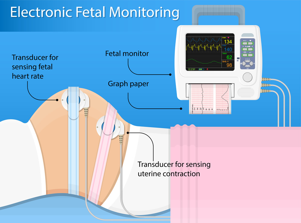 Guide to Maintenance of Medical Monitoring Devices Chemtronics